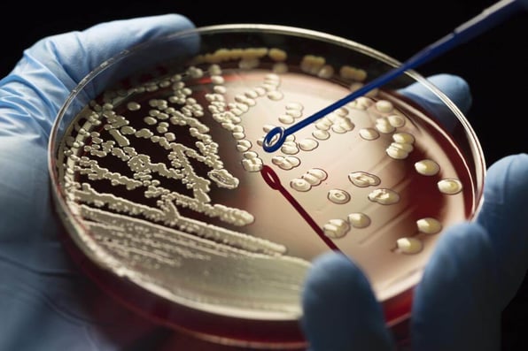 bacterial spoilage can be identified by